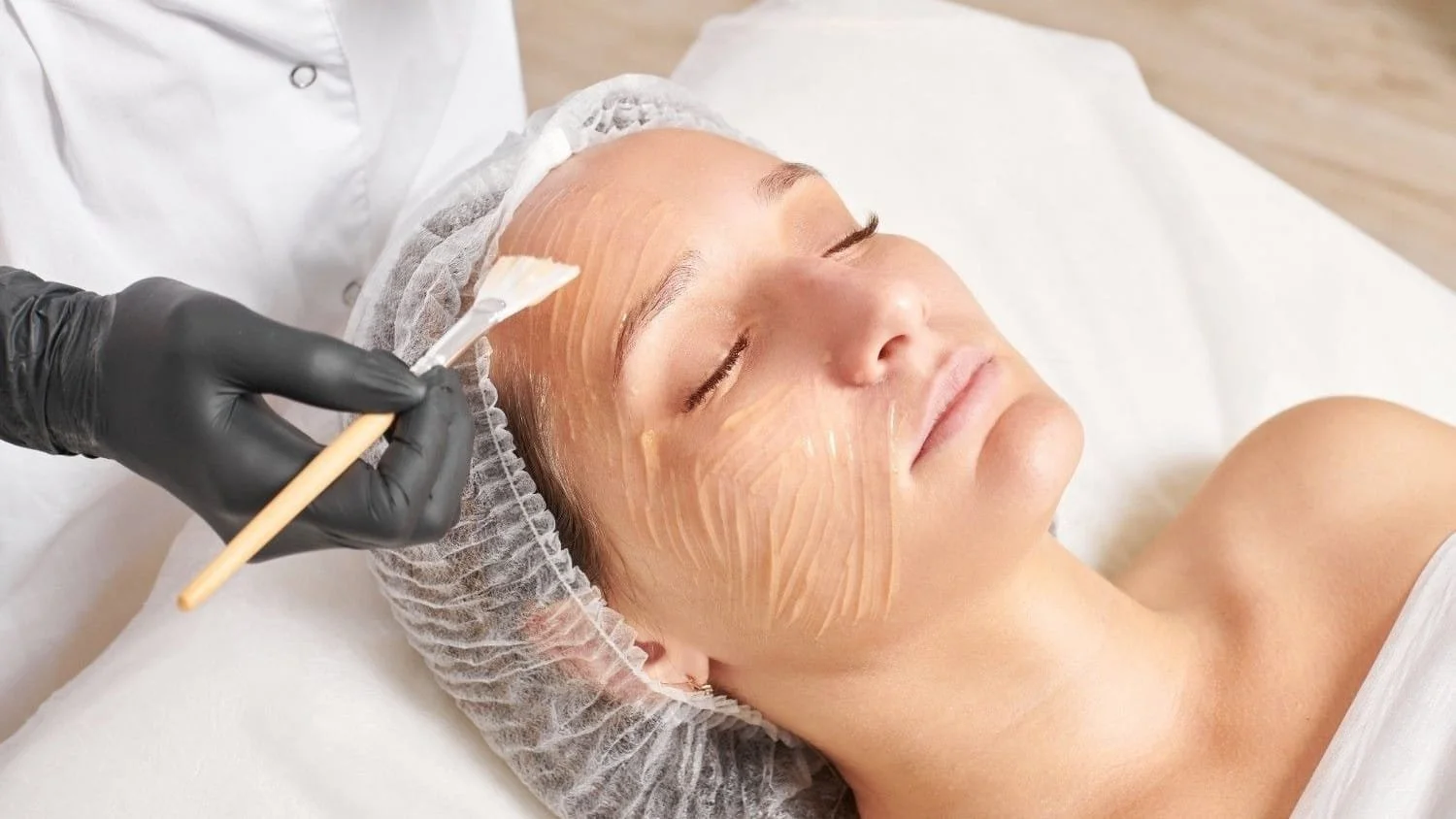 Chemical Peel or Microneedling? A Complete Guide to Choosing the Right Treatment