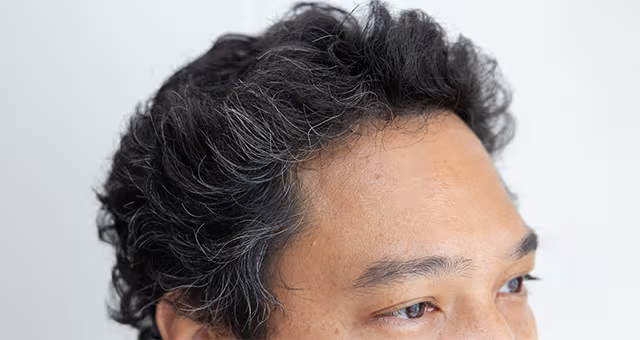 17 Ways to Improve Overall Hair Health, According to Dermatologists